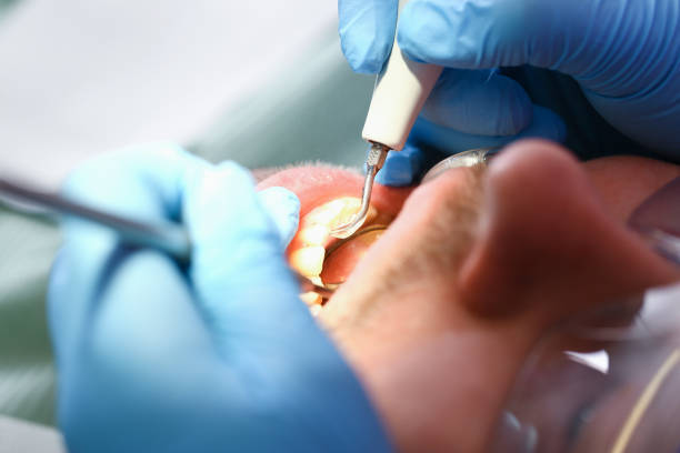 Best Dentist for Tooth Abscess  in Surf City, NC