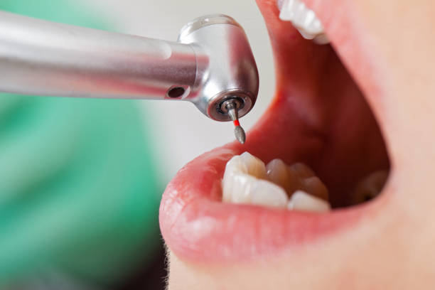 Best Knocked-Out Tooth Emergency  in Surf City, NC